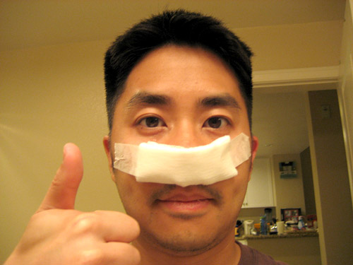 Learn what a deviated septum is, how it can be one of the more common causes 